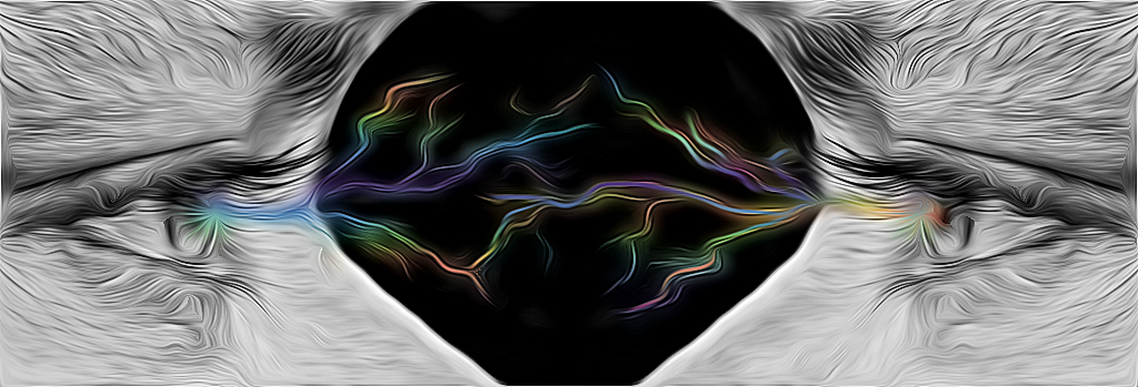 Auge Blitz 2-1-1.jpg